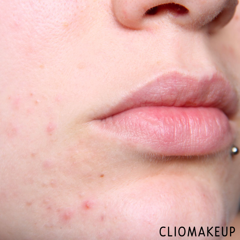 cliomakeup-recensione-correttore-skin-tone-concelaer-kiko-14