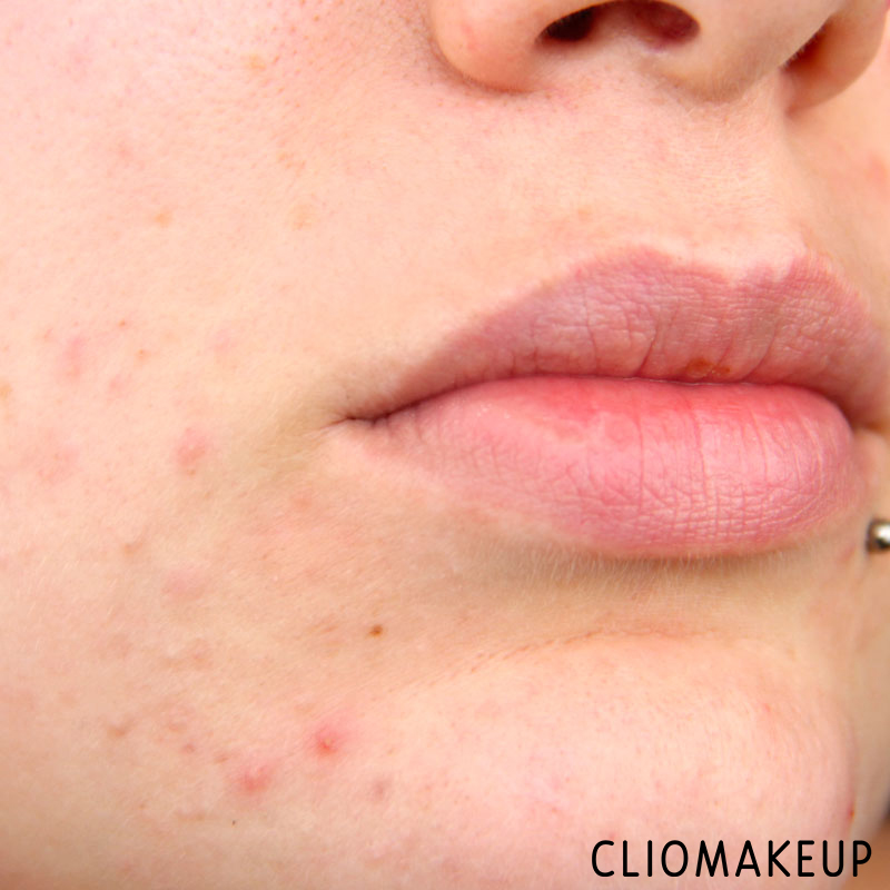 cliomakeup-recensione-correttore-skin-tone-concelaer-kiko-15