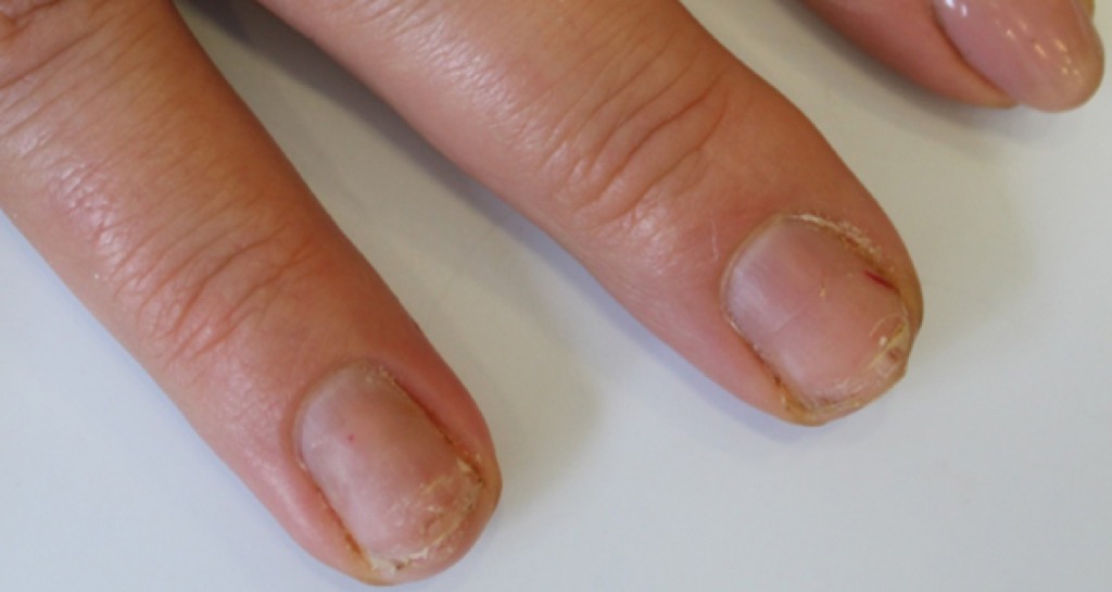 Unghie fragili e che si spezzano post manicure? I 5 step per ...
