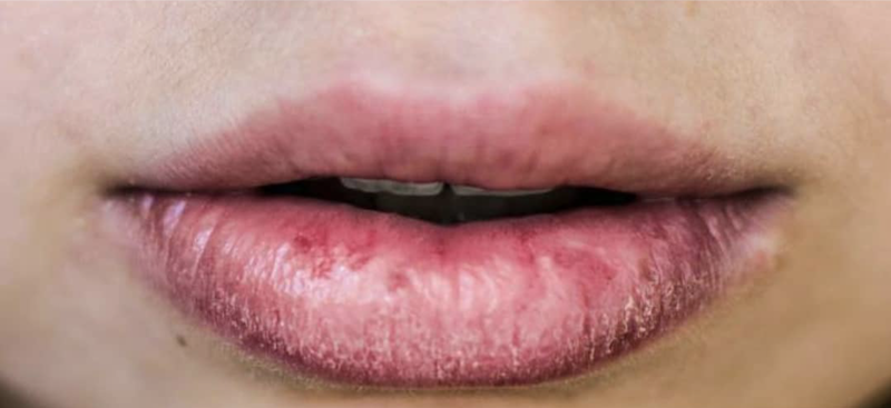 cliomakeup-labbra-secche-8-rimedi-naturali