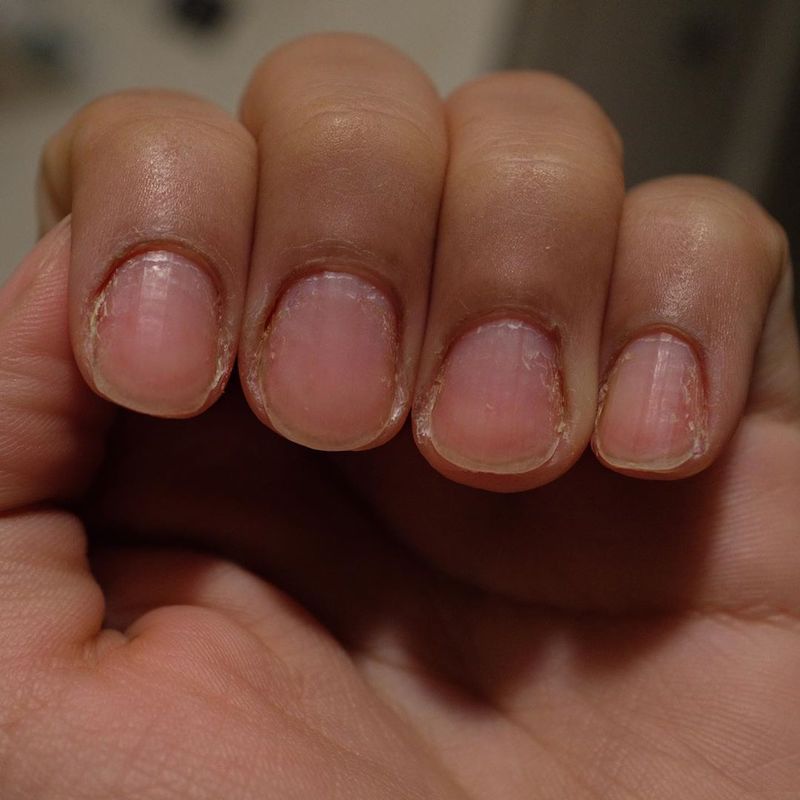 cliomakeup-trattamento-cheratina-unghie-teamclio-15