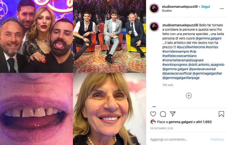 Cliomakeup-gemma-galgani-prima-dopo-14-denti-programma-selfie