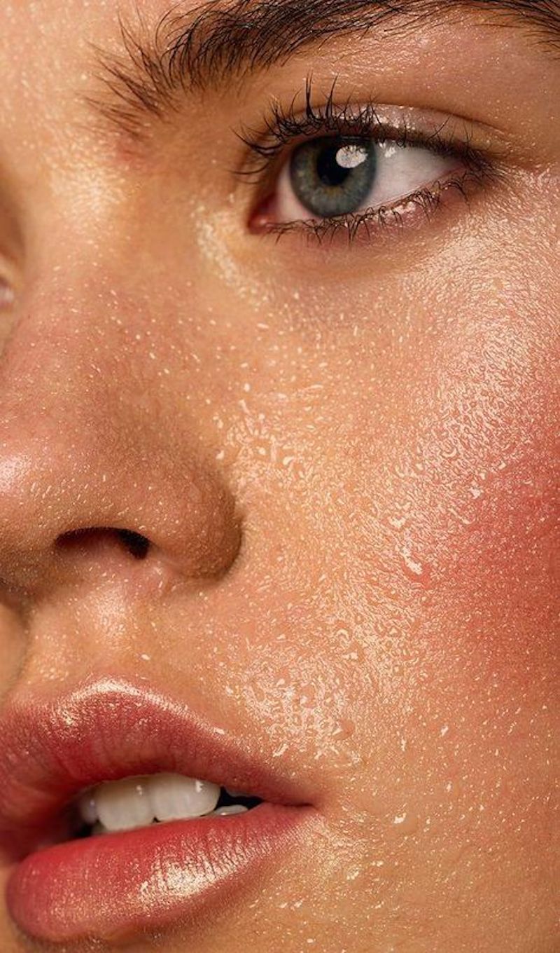 cliomakeup-irritazione-da-sudore-8