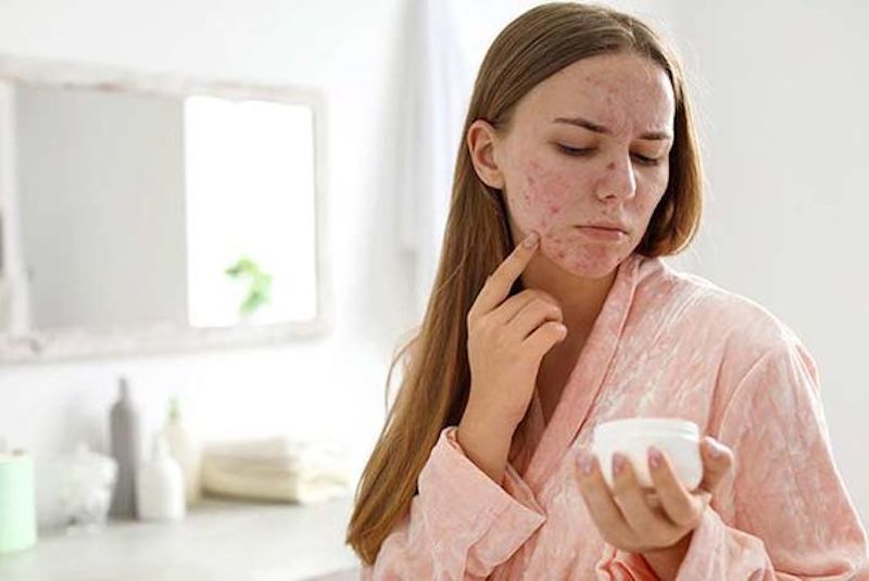 cliomakeup-pulizia-viso-estate-2020-10