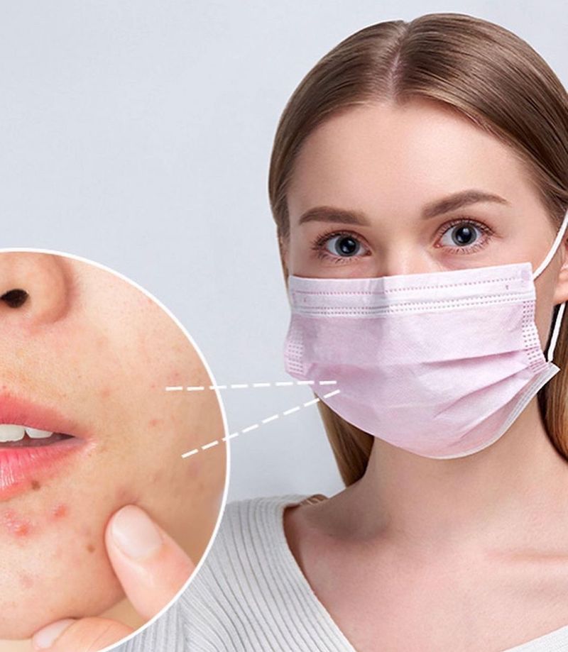 cliomakeup-acne-mascherina-teamclio-2-maskne