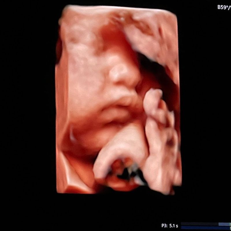 cliomakeup-chiara-ferragni-figlia-teamclio-2