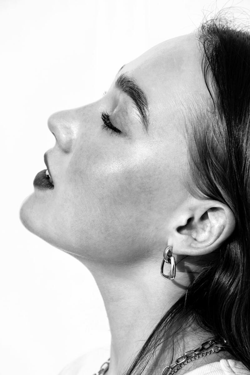 cliomakeup-melasma-cloasma-donne