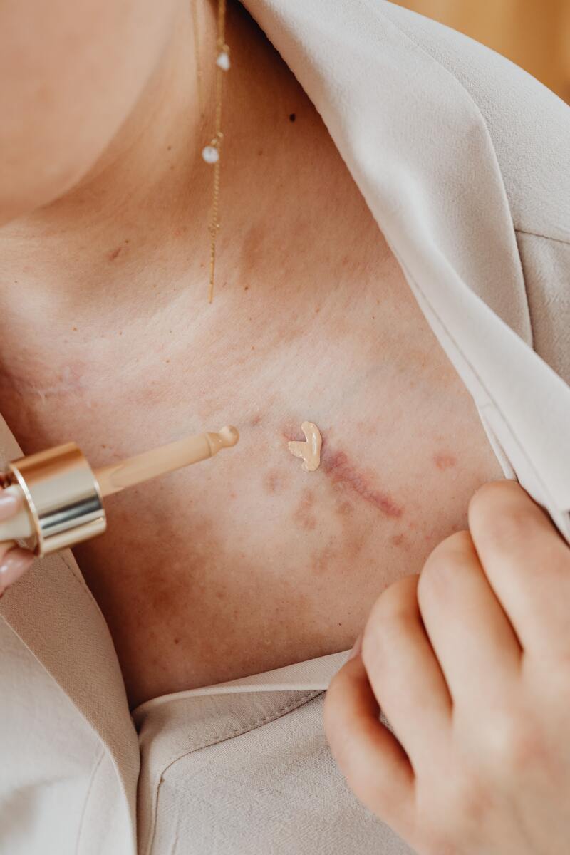 cliomakeup-come-scegliere-colore-correttore-online-cicatrice