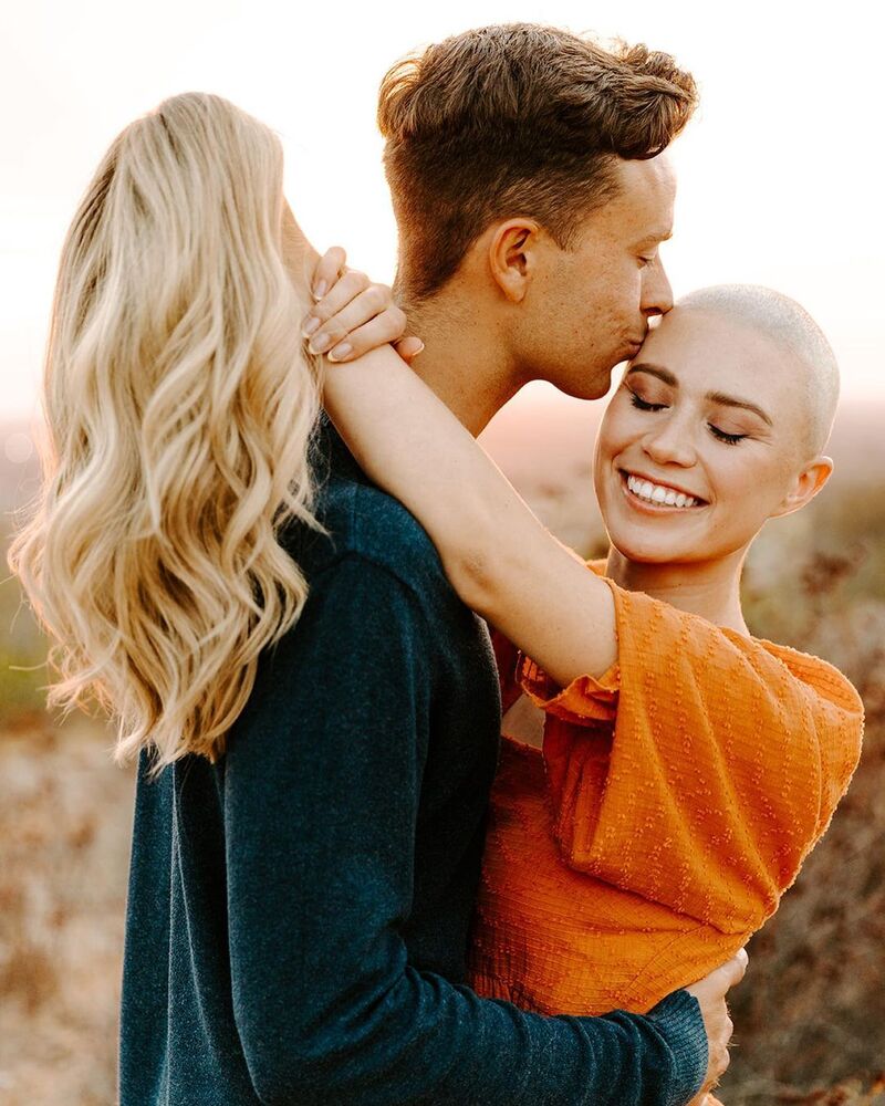 cliomakeup-alopecia-androgenetica