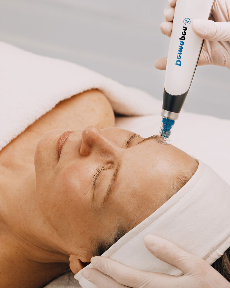 cliomakeup-trattamenti-viso-pelle-matura-dermapen