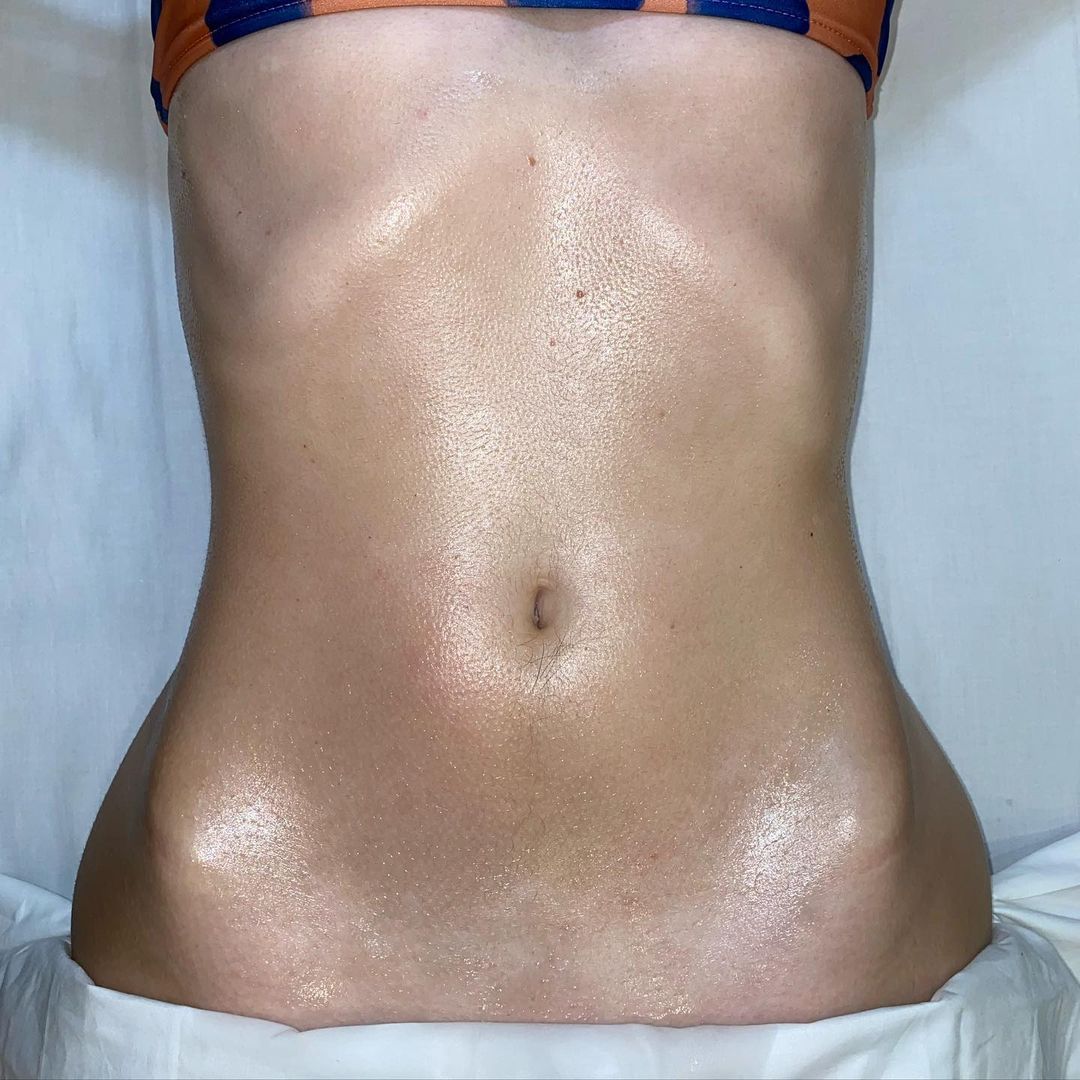 Cliomakeup-post-metodo-renata-franca-addome-trattato