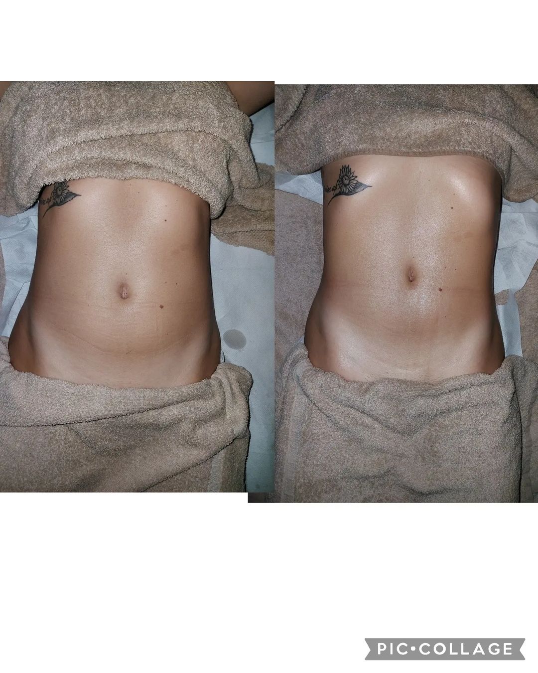 Cliomakeup-post-metodo-renata-franca-prima-dopo-mracle-touch