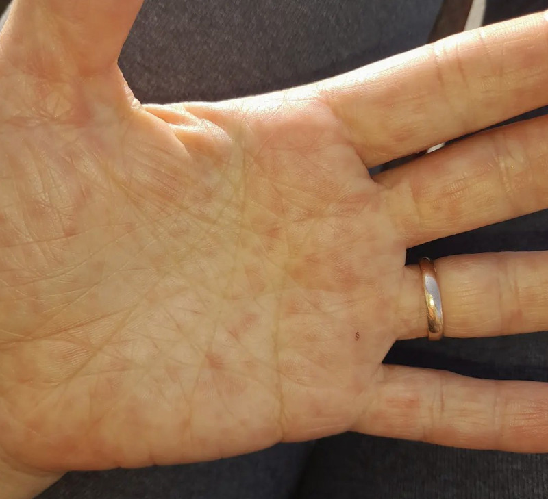 cliomakeup-bocca-mani-piedi-adulto