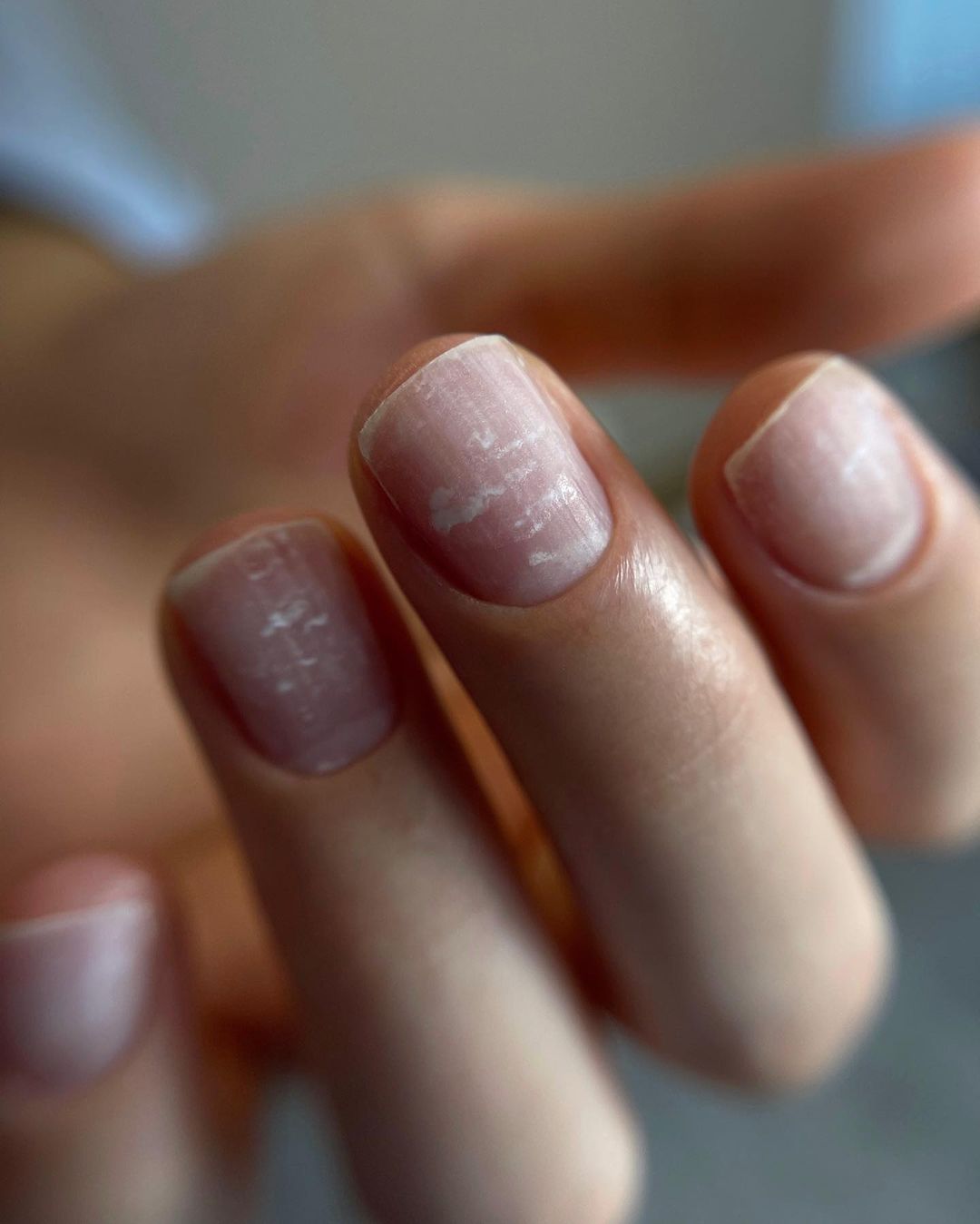 cliomakeup-macchie-bianche-sulle-unghie-cosa-sono-perche-vengono-e-i-rimedi-3