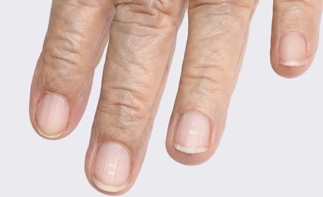 cliomakeup-macchie-bianche-sulle-unghie-cosa-sono-perche-vengono-e-i-rimedi-6