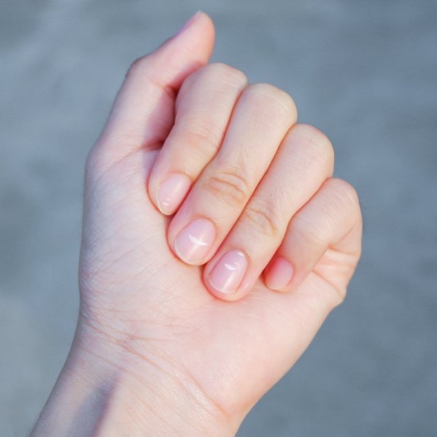 cliomakeup-macchie-bianche-sulle-unghie-cosa-sono-perche-vengono-e-i-rimedi-7