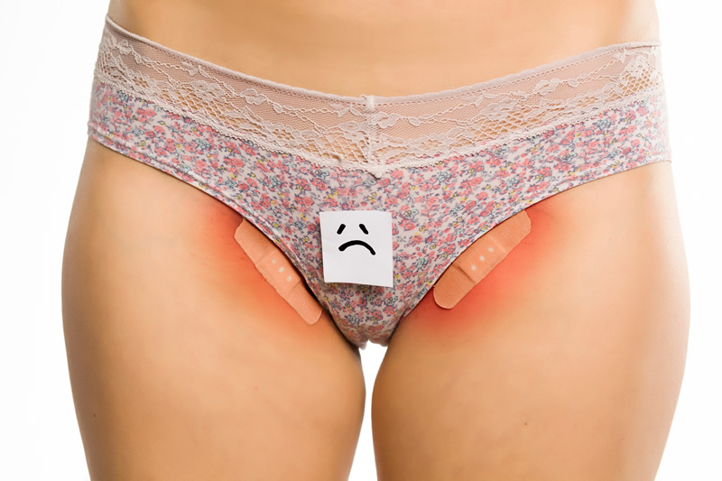 laser-inguine-dolore