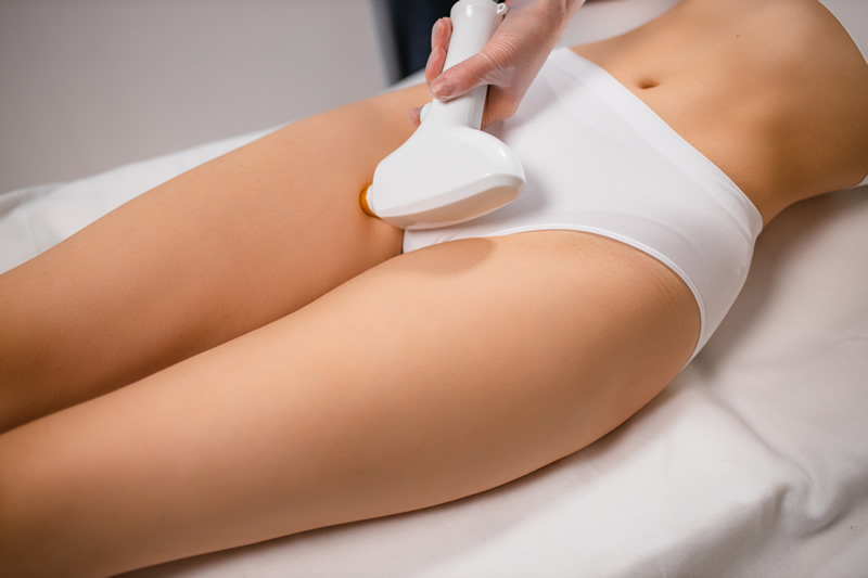 laser-inguine-manipolo