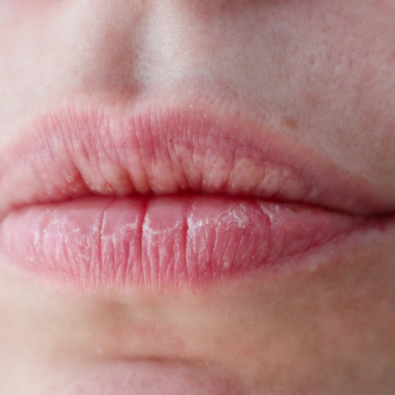 cliomakeup-labbra-secche-rimedi-2