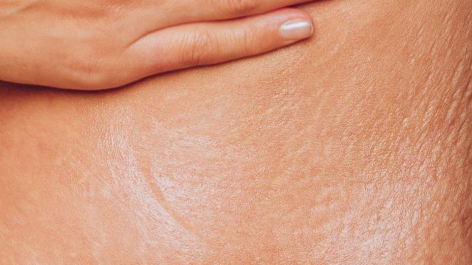 come-usare-crema-egyptian-magic-utilizzi-prodotto-smagliature