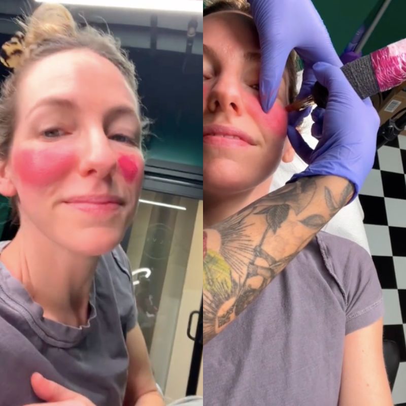 blush-tattoo-trattamento