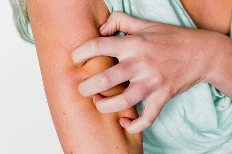 come-usare-acqua-termale-la-roche-posay-insetti