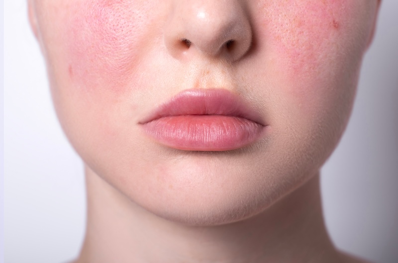 come-usare-acqua-termale-la-roche-posay-pelle-sensibile