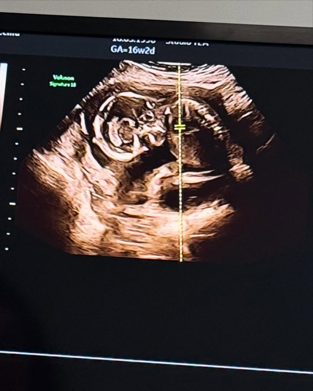 cecilia-rodriguez-incinta-ecografia