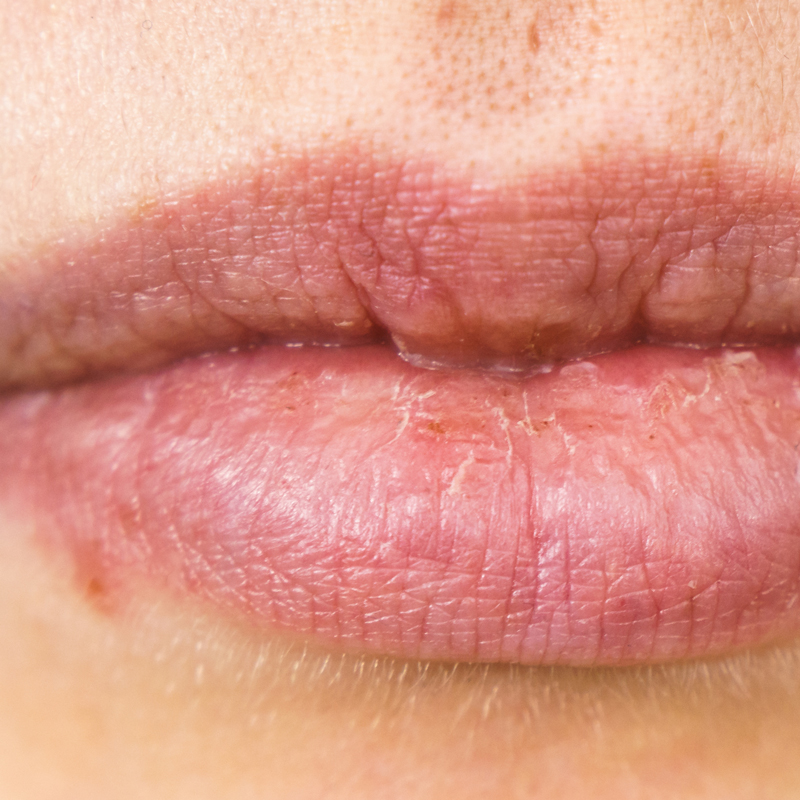 come-usare-nivea-crema-corpo-repair-care-labbra