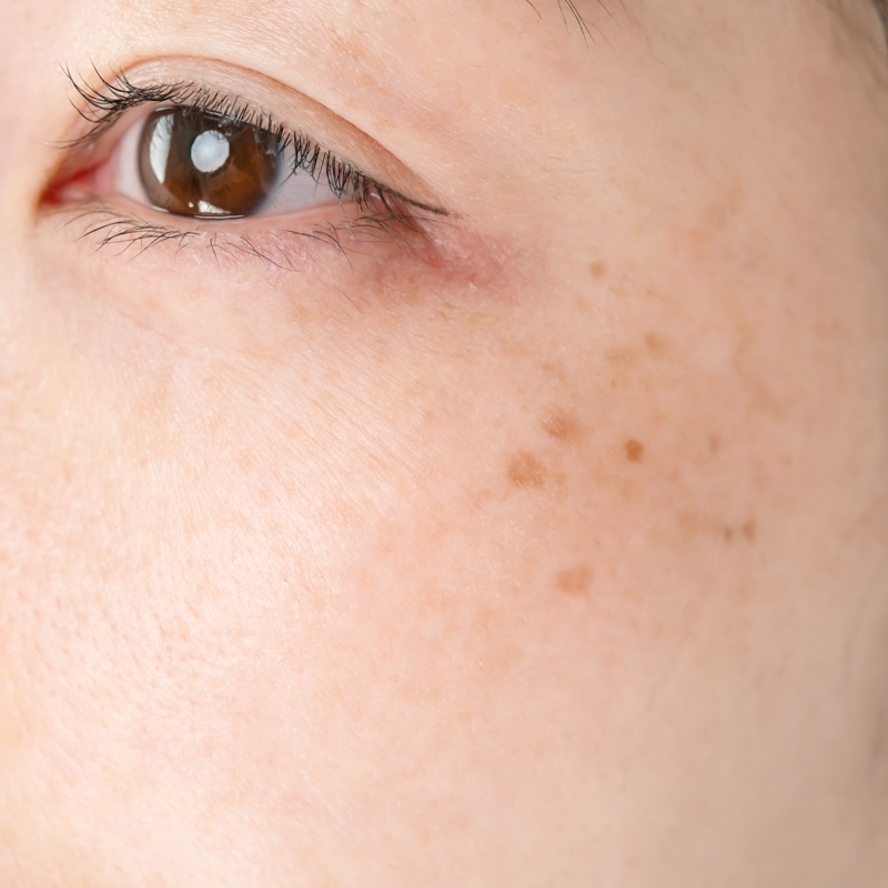 come-usare-rilastil-sun-system-stick-solare-trasparente-spf50-macchie