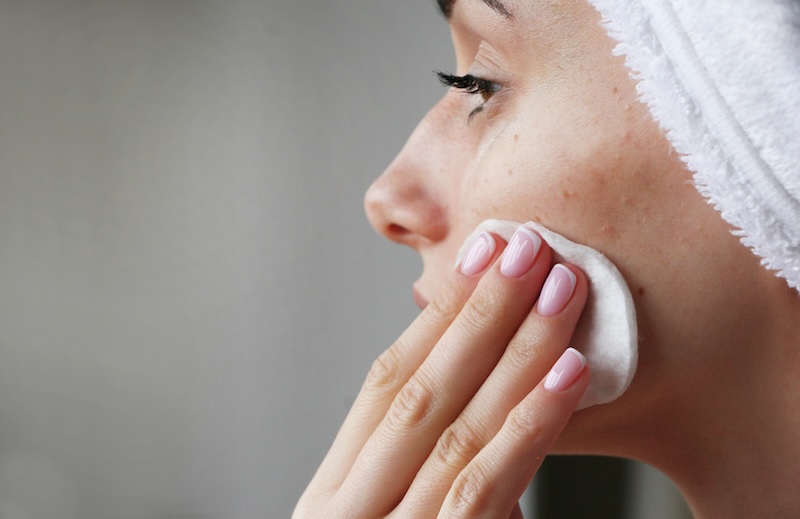 cliomakeup-aloe-vera-acne