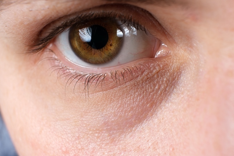 cliomakeup-aloe-vera-occhiaie