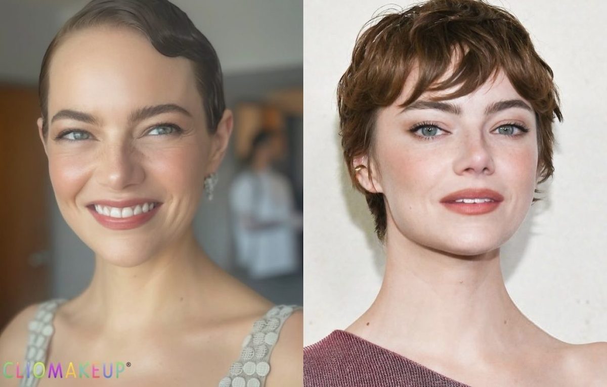 emma-stone-prima-dopo-cover