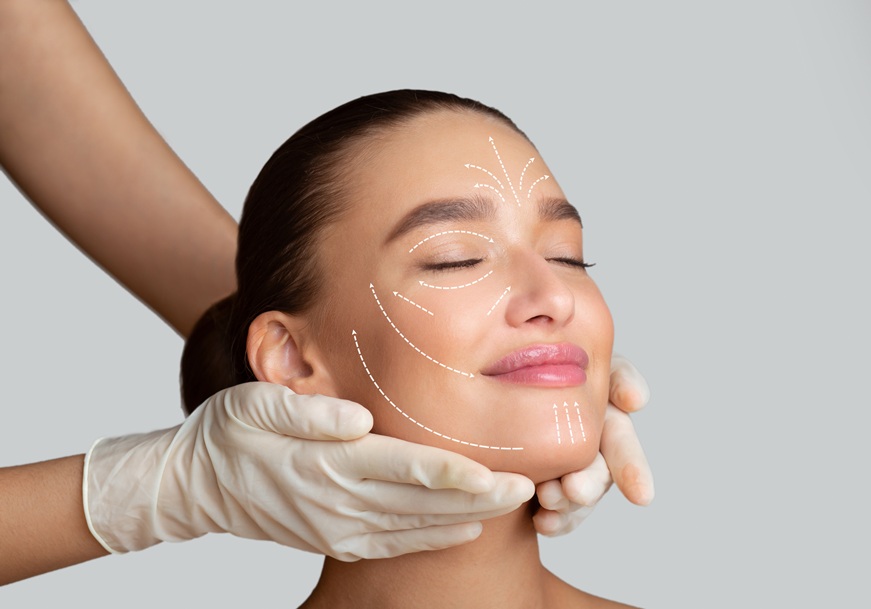 Lifting-liquido-sorriso