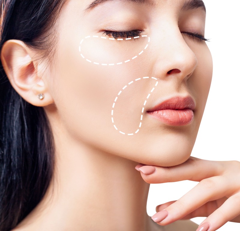 acido-polilattico-effetti-collaterali