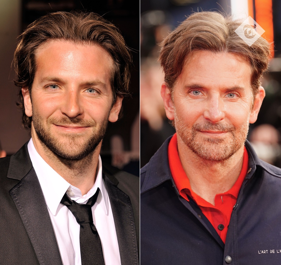 bradley-cooper-prima-dopo-faccia