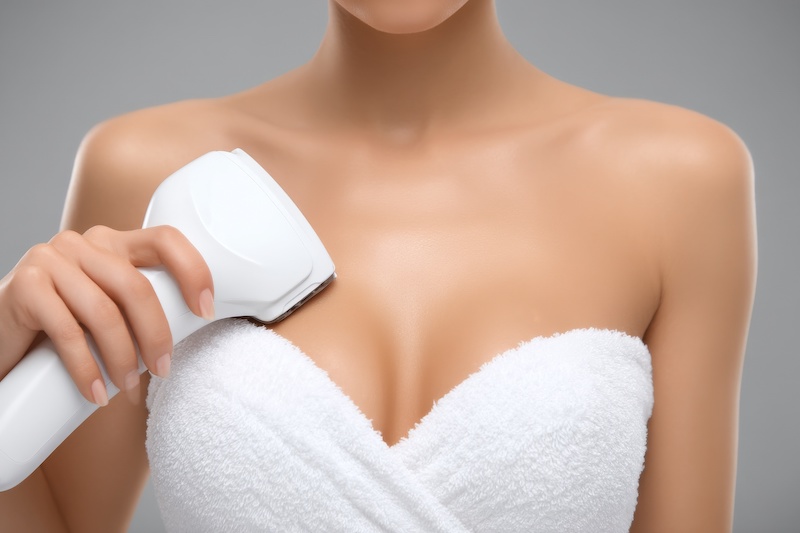 smagliature-seno-laser