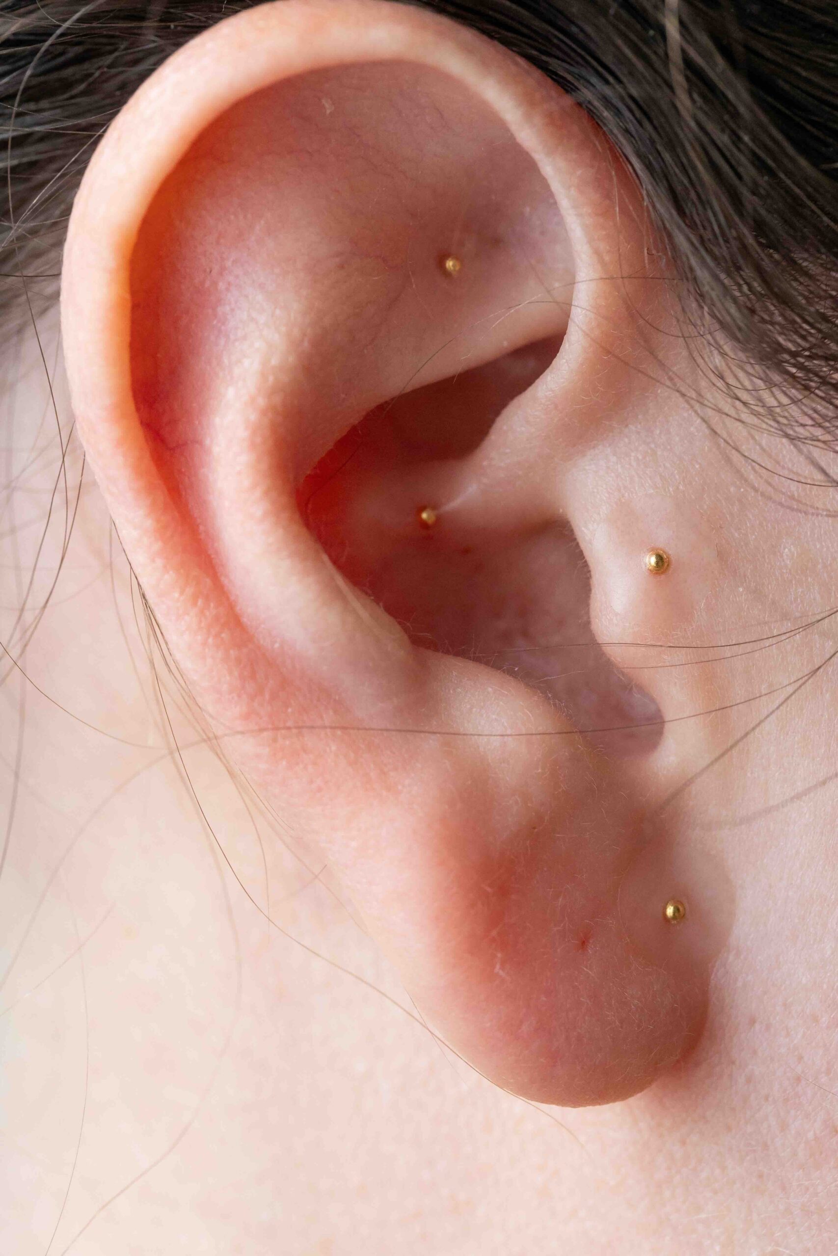 applicazione-ear-seeding-orecchio-