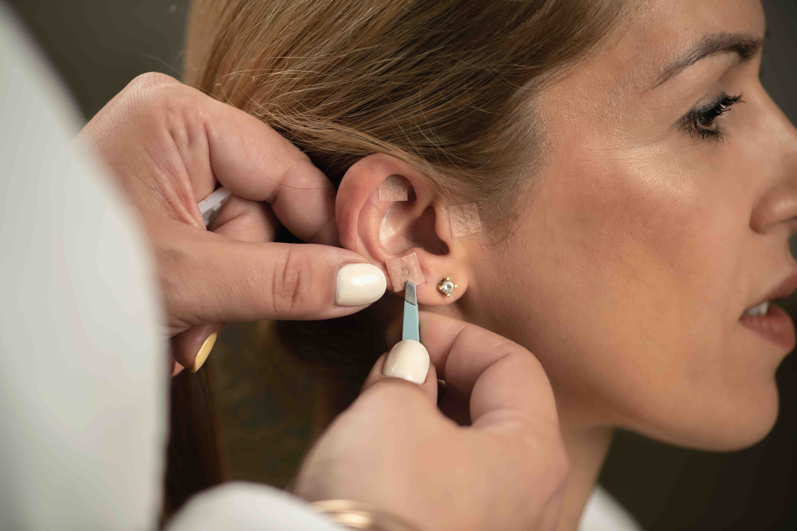 auricoloterapia-applicazione-orecchio