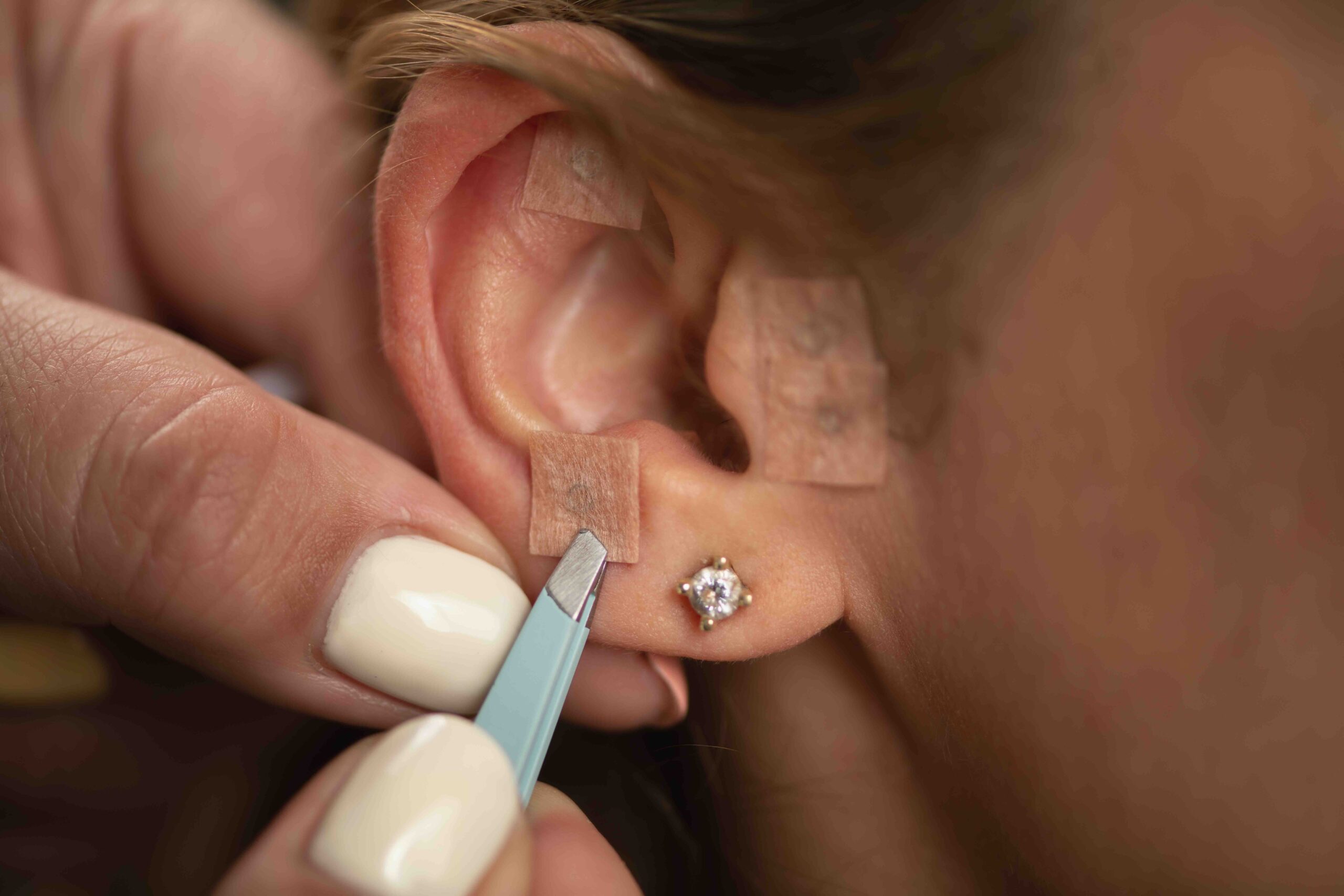 come-applicare-ear-errings-agopuntura