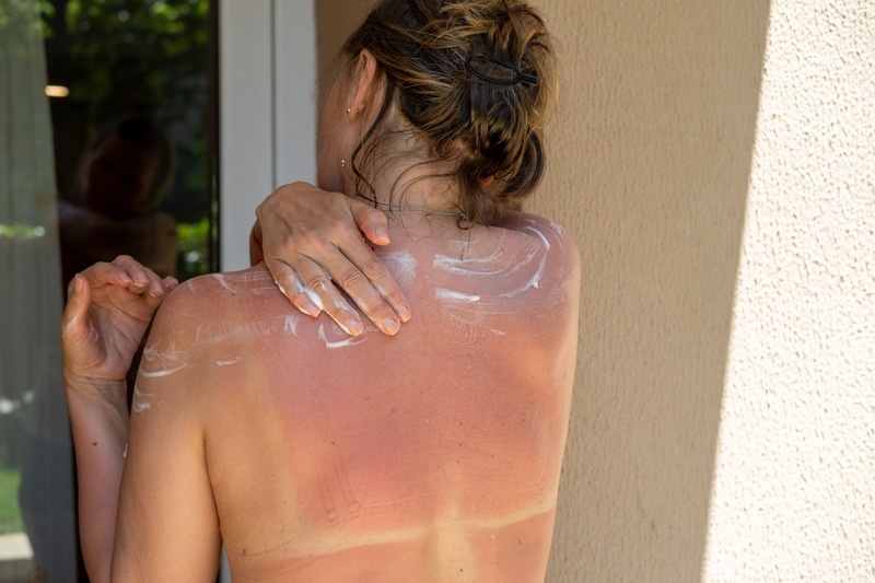 maglia-anti-uv-eritema-solare